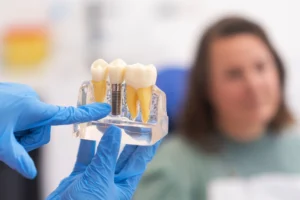Ein Zahnarzt zeigt ein Modell mit einem Zahnimplantat und einer Krone – Symbol für die moderne Lösung bei Zahnlücken und die damit verbundenen Kosten für Zahnimplantate. Perfekt für Patienten, die sich über Implantate und Zahnzusatzversicherungen informieren möchten.