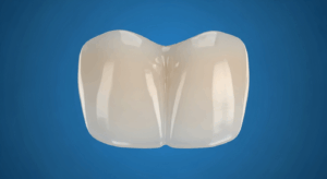 Nahaufnahme eines menschlichen Backenzahns auf blauem Hintergrund