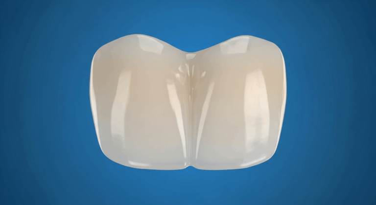 Nahaufnahme eines menschlichen Backenzahns auf blauem Hintergrund