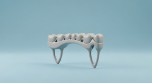3D-gedruckte Zahnbrücke auf blauem Hintergrund