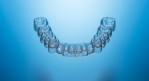 Transparente Zahnspange vor blauem Hintergrund