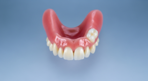 Unterkiefer-Zahnersatz mit künstlichem Backenzahn