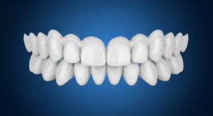 3D-Darstellung eines menschlichen Gebisses