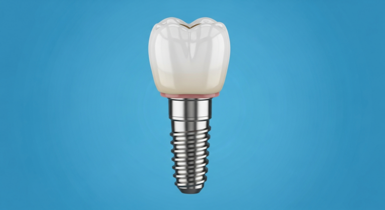 Zahnimplantat aus Metall und Keramik auf blauem Hintergrund