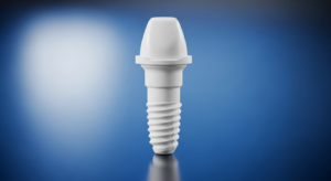 Zahnimplantat aus Keramik auf blauem Hintergrund