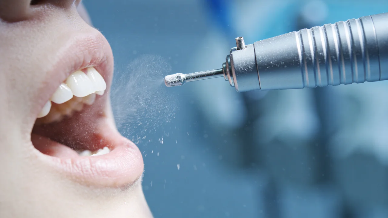 Zahnarztbohrer nahe offenem Mund mit Wasserspray